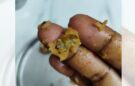 Customer finds screw in veg Manchurian at Brown Bear Bakery, Nizampet